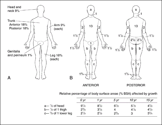 تریاژ سوختگی Burn Triage